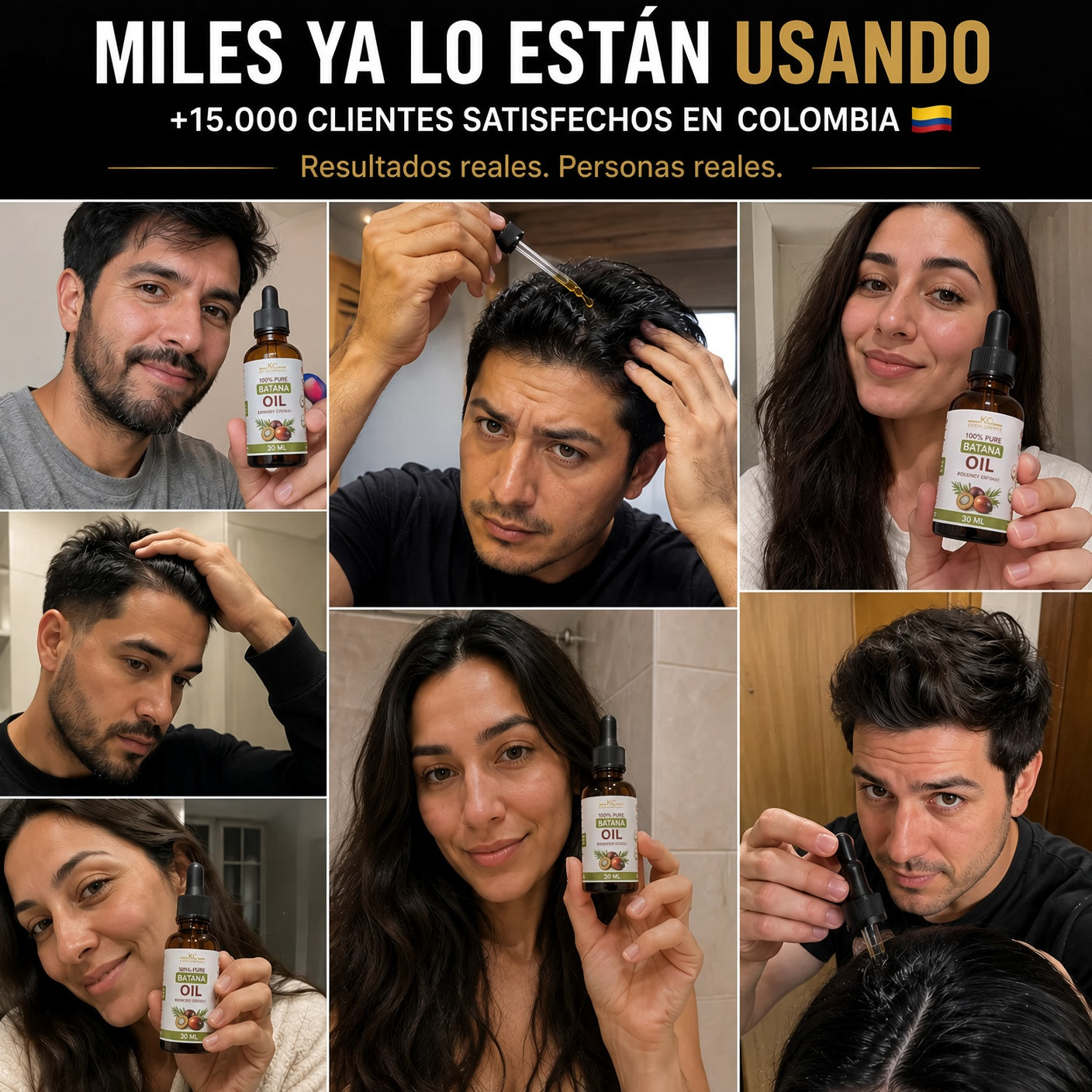 🌿Aceite Capilar Batana™ – Menos caída, cabello más fuerte