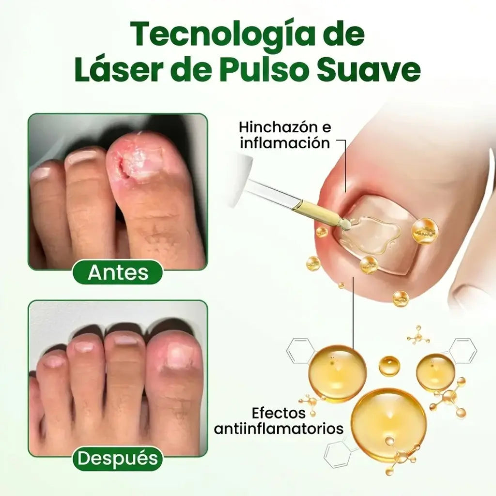 (2x1) Tratamiento anti hongos 100% NATURAL 7 Days