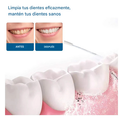 Irrigador Oral Eléctrico®