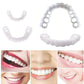 CARILLAS DENTALES