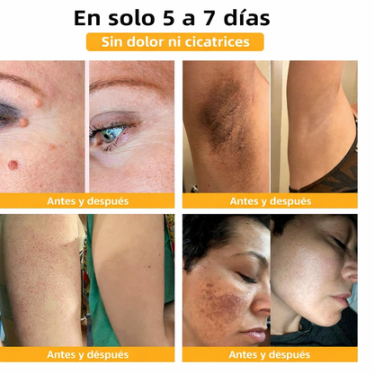 Bee Venom® - Efecto Tensor y Lifting Natural
