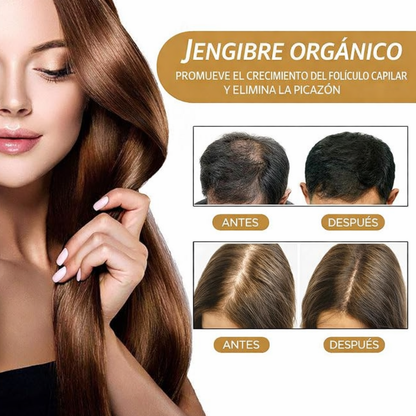 NaturWash® - Shampoo Capilar En Barra (x2 Unidades)