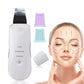 Espátula Ultrasónica de Limpieza Facial Profesional