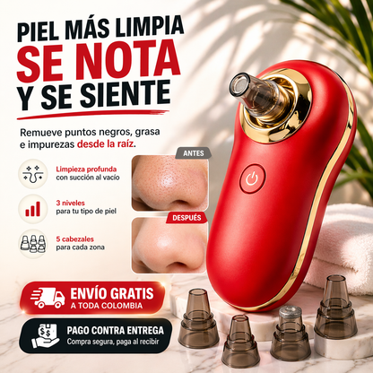 Porex® - Removedor Puntos Negros