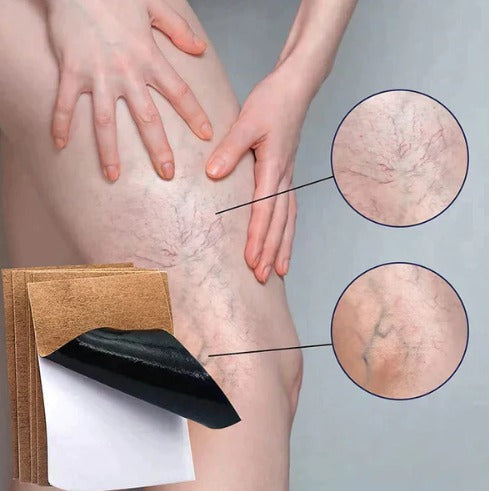 VEINS CARE 2x1 — imagen comparativa